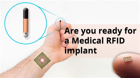 scanning for rfid chips on body|Human Microchipping: An Unbiased Look at the Pros and Cons.